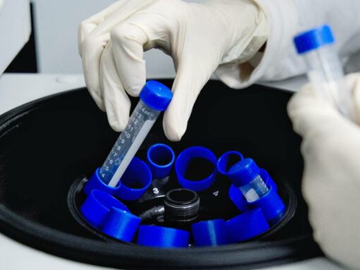 4 Plastic Finishing Types and Their Applications